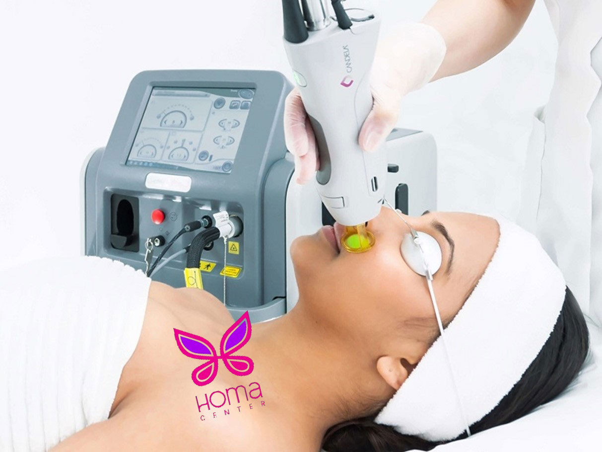 آیا لیزر خانگی هماسنتر موثر است؟ بررسی تخصصی